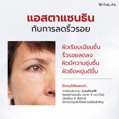 [ซื้อ 1 แถม 1] Vitalife Astaxanthin Ultra Complex with CoQ10 | วีต้าไลฟ์ แอสตาแซนธิน พลัส  | 8 แคปซูล*2- รวม 16 แคปซูล